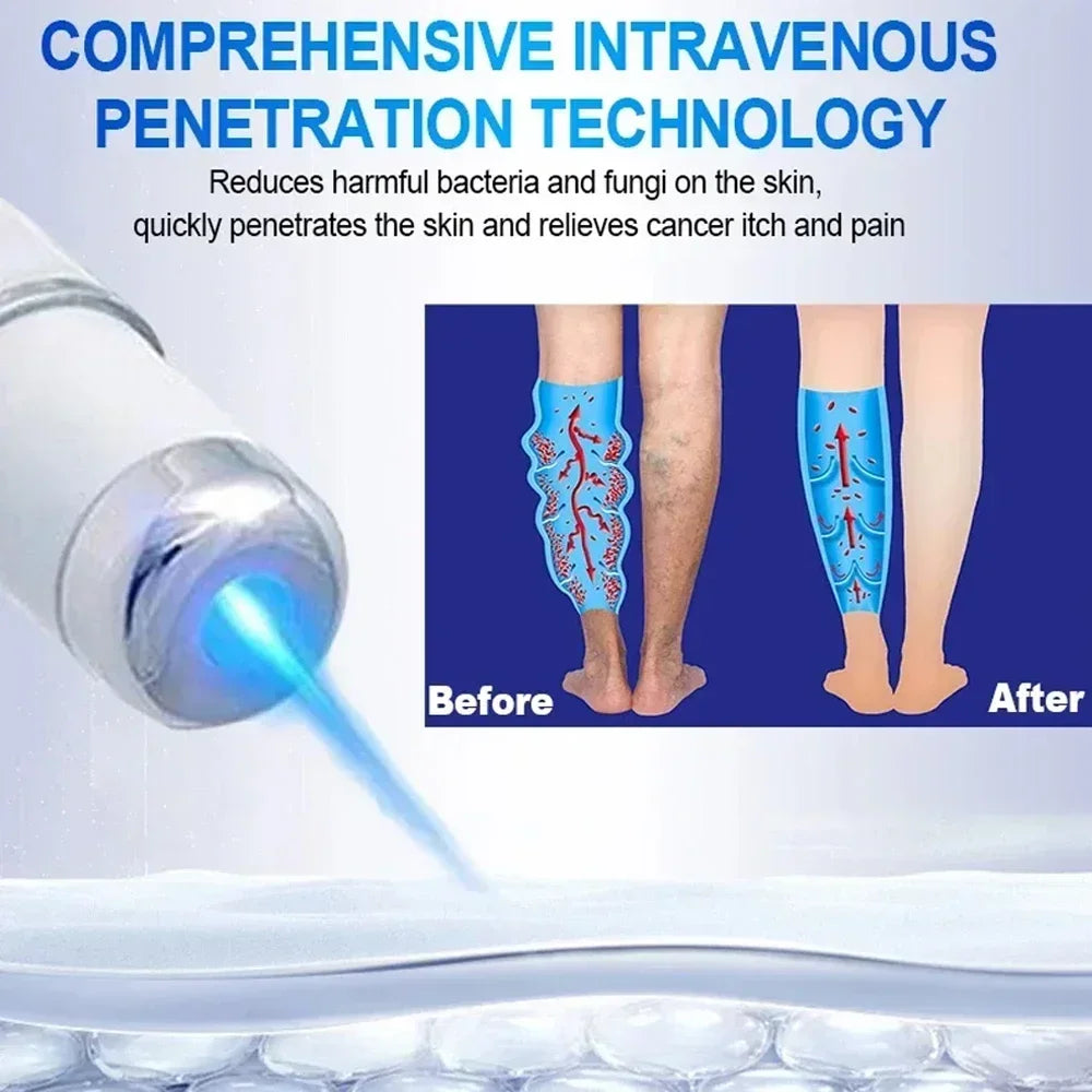 Blue Light Laser Therapy Pen - Image 5